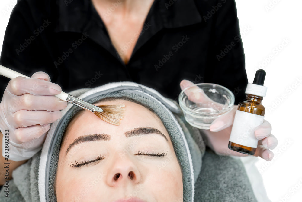 Chemical Peels